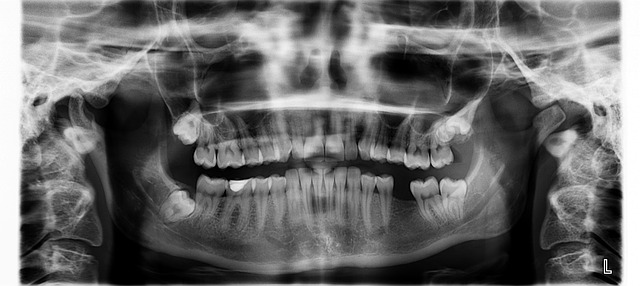 zubní rentgen